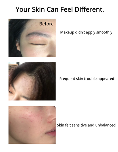 Suipl Pristine All-Care Serum Set of 2